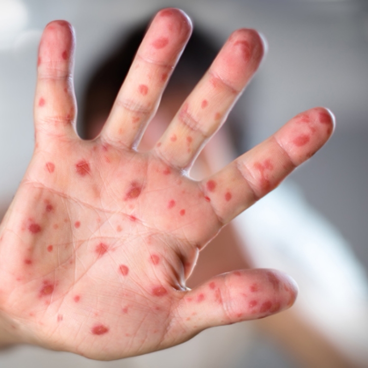 Рубрика «Советы врача»